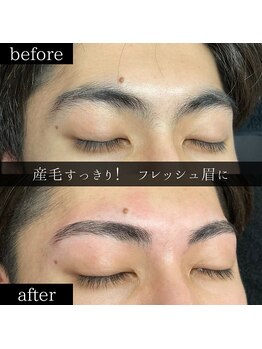 ユー 千葉駅前店(you)/ビフォーアフター写真