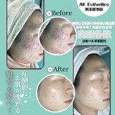 エーケーエステティックス 熊本新市街店(AK Esthetics)