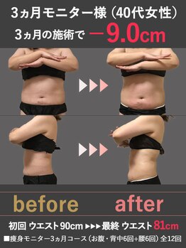 蓮子の夢/3ヶ月でウエスト－9cm！