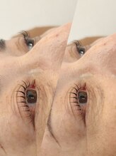 アイラッシュサロン エフ(f)/プレミアムまつ毛パーマ☆