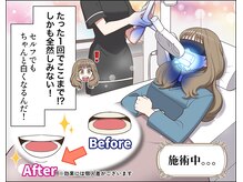 ユーラボ 表参道(YOU-LAB)/（４）漫画/ホワイトニング