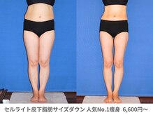 ピュアノア 三木店/痩身　三木/小野/西脇/加東/加西