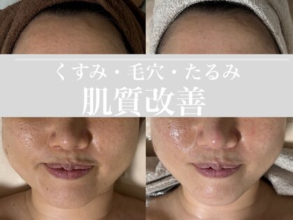 メロー(MELLOW)の写真