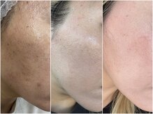 エイチケービューティーサロン(H/K beauty salon)の雰囲気（今のケアが未来の肌を変える！本気で美肌を目指すためのサロン★）