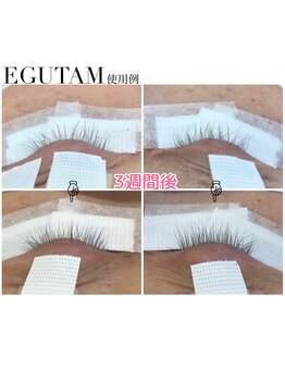 エマ 阿佐ヶ谷(EmmA)/【店販】エグータムEGUTAM