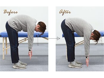 初台メディカルラボ整体院/【ビフォーアフター(2)】