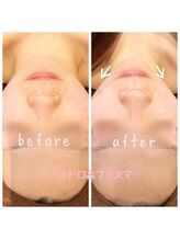 デジール(DESIR)/肌質改善★理想の組み合わせ