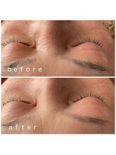 メナードフェイシャルサロン 岐阜茜部/ビューネケアパック