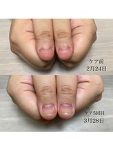 ロイ 初生店(LOI)/自爪育成３ヵ月コース