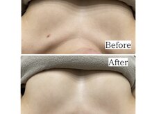 ホーミー(Homie)/バストケア◎