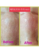 スリール(sourire)/施術30年以上の実績!