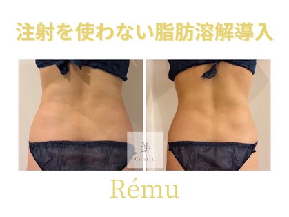 レミュ(Remu)の写真