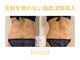レミュ(Remu)の写真