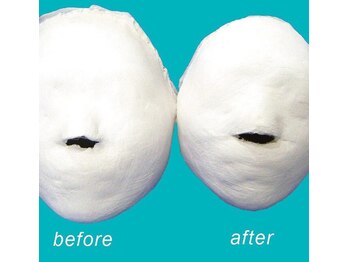 小顔 ツヤ肌/小顔コルギ