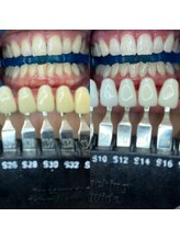 トウキョウスワーズ 池袋店(TOKYO SWRS)/#ホワイトニング #池袋 #渋谷