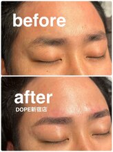 ドープ 新宿南口店(DOPE)/[メンズ/眉毛/アイブロウ/新宿]