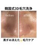 毛穴の黒ずみ・角栓が消える◎韓国式3D毛穴洗浄　￥15000→￥8800