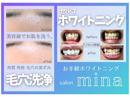 ミナ(mina)の写真