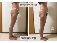 ピーチ(Peach)/骨盤矯正×ダイエット×美尻