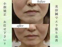 ファミリアくわな鍼灸院の雰囲気（たるみ/エラ/目の開きなど顔のコンプレックスを改善します！）