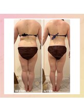 エステサロン ブレス 長町南店(BLESS)/痩身結果