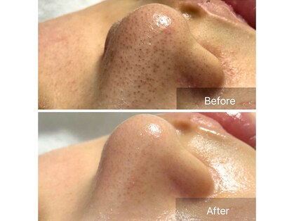 ラルム(Larme)の写真