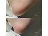 【足裏角質除去】かかとツルツル◎角質ごっそり除去コース