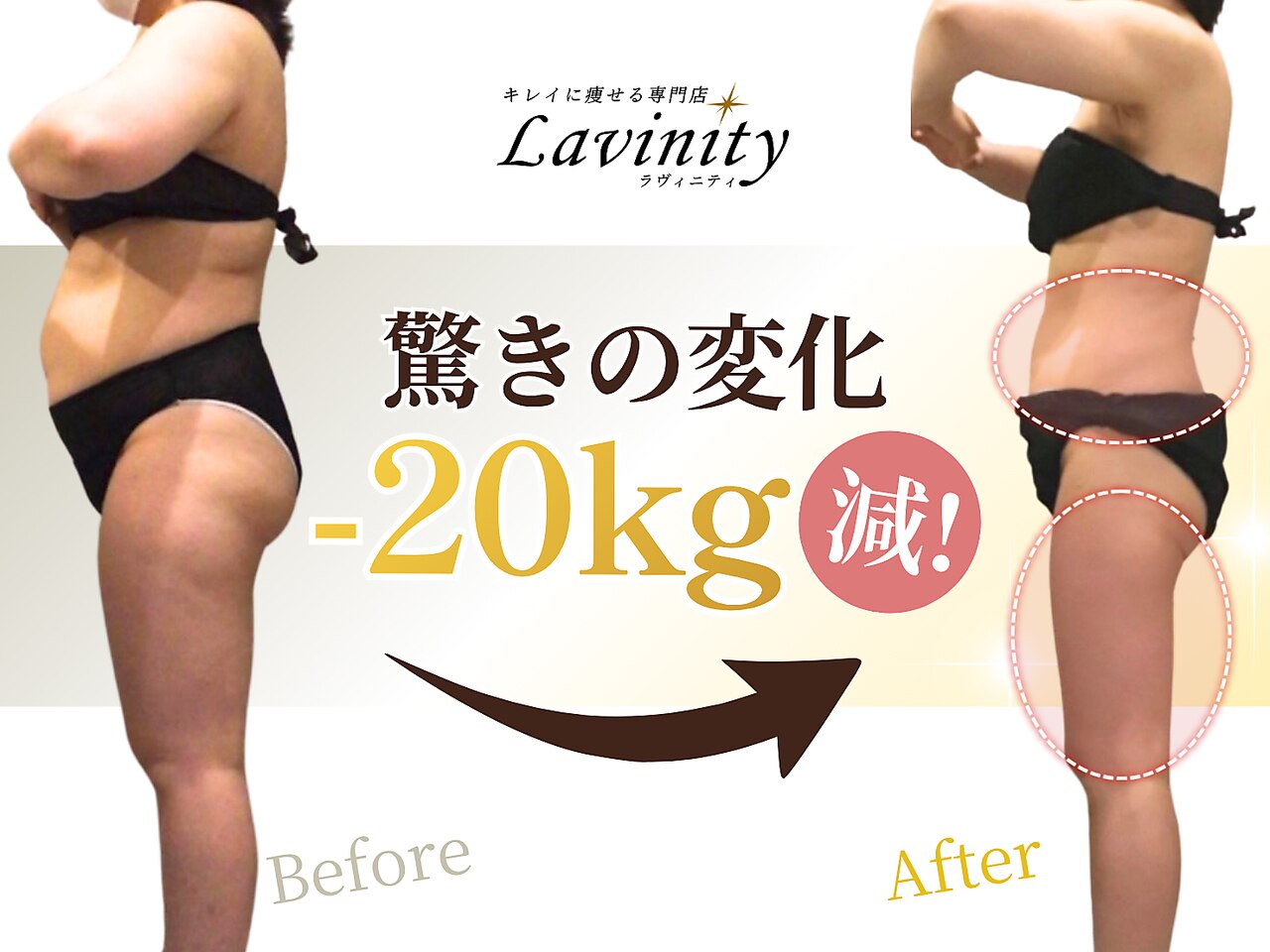 ラヴィニティ 五反田店(Lavinity)｜ホットペッパービューティー