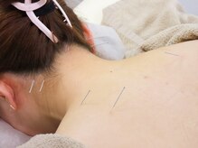 世珍鍼灸院 門前仲町店の雰囲気(肩こりや首こり、慢性的な疲労、むくみ、美容目的のケア◎)
