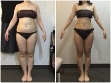 美容整体ウェリナ あま甚目寺院/小顔矯正/骨盤矯正/美脚サロン