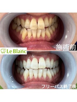 ルブラン 奈良店(Le Blanc)/おすすめのコースございます!