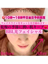 ハニーアイズ(Honey Eyes)/【BBLフェイシャル体験】