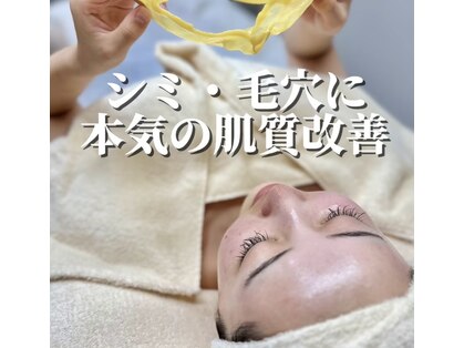 チル(Chill)の写真