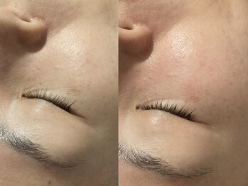 シェリー(CHERIE)/見て!艶!