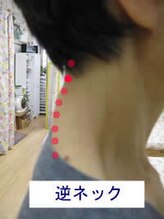 エスコート芦屋サロン/50代　女性　首の歪み