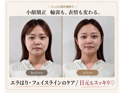 アズール(azure)の写真