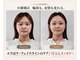 アズール(azure)の写真