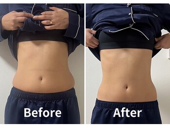 サンク(Cinq)/【腸もみ+骨盤矯正】ファムケア