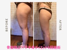 練馬アカデミア美容整体院の雰囲気（美容整体院自慢の下半身ダイエット/骨盤矯正(通常は衣類着用)）