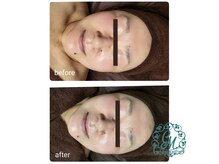 ネイルサロン シャルマン(Nail Salon CharMant)の雰囲気（フェイスラインスッキリ(60歳後半女性)@118cwjwhへ）