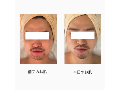 ハリスキンラボ(Hari.Skin.Lab)の写真