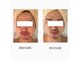 ハリスキンラボ(Hari.Skin.Lab)の写真