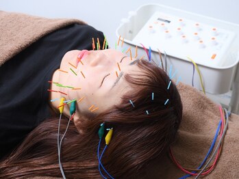 ウル鍼灸整骨院/美容鍼(^^)