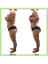 ウェルース(Velus)/超発汗でこの変化！