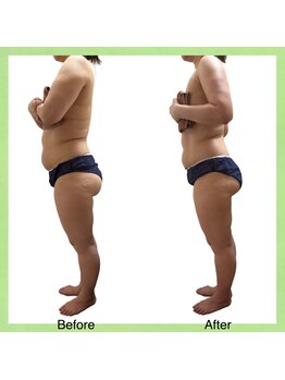 ウェルース(Velus)/超発汗でこの変化!