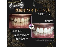 リニューアルした医療ホワイトニング♪ご体感ください♪