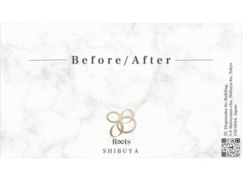 ルーツ 渋谷店(R∞ts)/B e f o r e / A f t e r