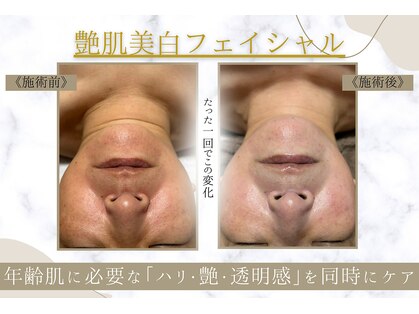 アラン(Aran)の写真