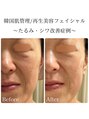 ロイヤル(ROYAL)&nbsp;再生美容で目元のシワ、透明感UP◎若々しい印象へ♪
