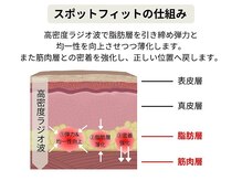 ルディラ医療提携エステ 立川店 毛穴/小顔/ニキビ・シミ・美白・シワ・たるみケア/スポットフィット